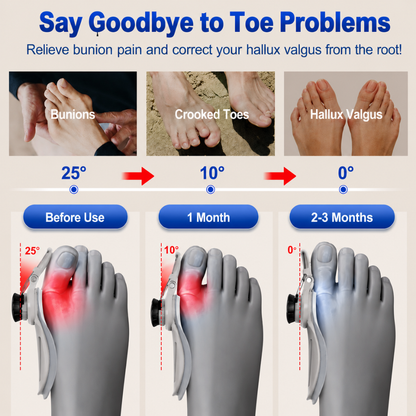 Prova & Co Adjustable Bunion Corrector